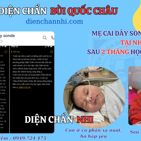 MẸ HÀN QUỐC GIÚP BÉ 2 THÁNG BỎ ĂN DÂY SONDE